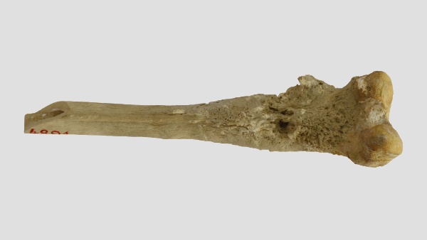 Fotografie. Fotografie. Zhoubný kostní nádor, osteosarkom, na dolním konci stehenní kosti. Exemplář ze sbírek antropologického oddělení NM. Zdroj: Národní muzeum
